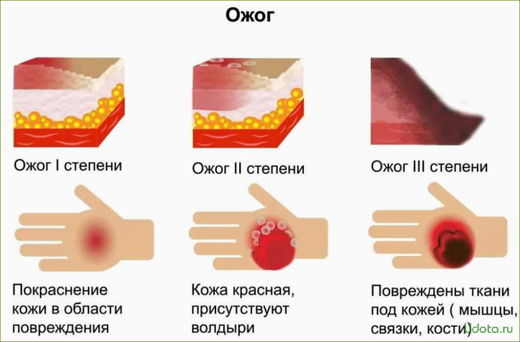 Химический ожог растений: причины возникновения и методы борьбы